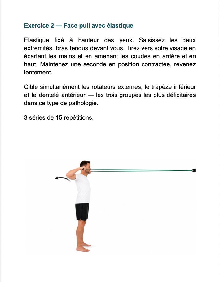 Extrait — Exercice, face pull avec élastique